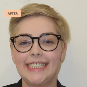 Bec smiling without braces