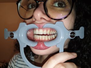 photos in dental monitoring back teeth not visible