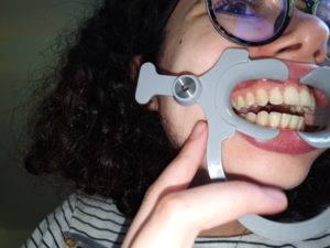 photos in dental monitoring not centred