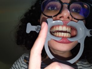 photos in dental monitoring not centred