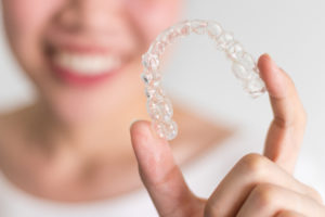 clear aligners
