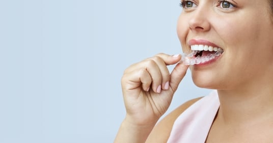 Invisalign clear aligners