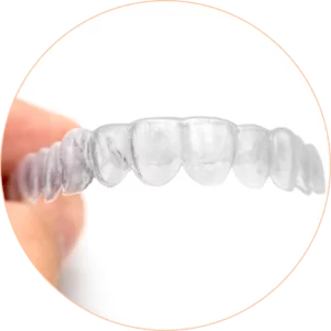 Removable Retainer
