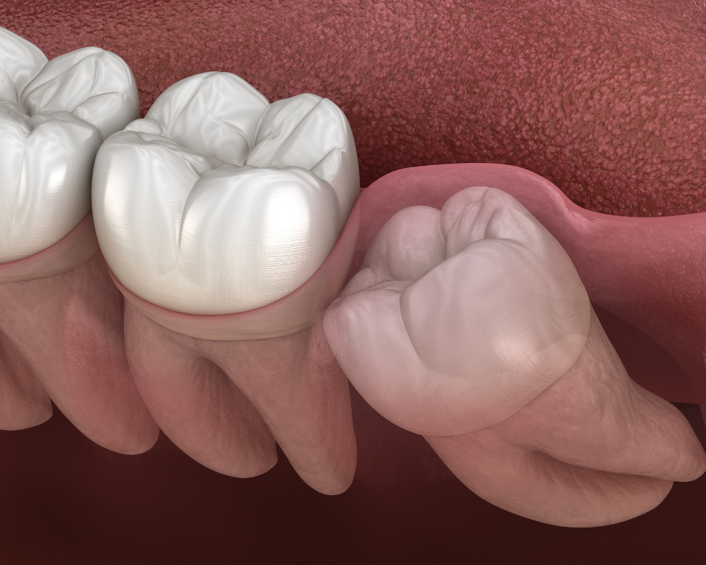 Tooth exposure Transform Orthodontic Care