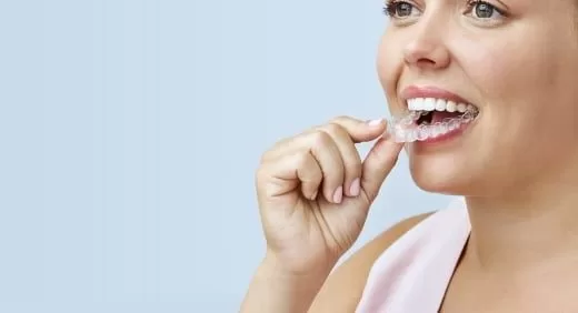 Invisalign clear aligners